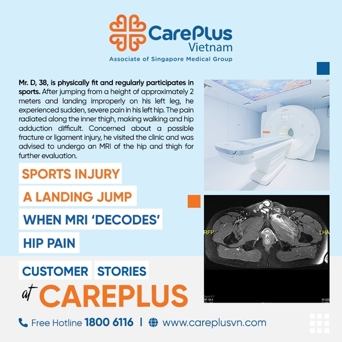 SPORTS INJURY AFTER A LANDING JUMP – WHEN MRI “DECODES” HIP PAIN