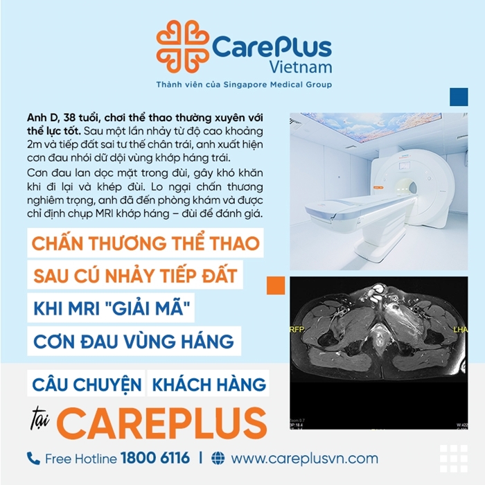 CÂU CHUYỆN KHÁCH HÀNG: CHẤN THƯƠNG THỂ THAO SAU CÚ NHẢY TIẾP ĐẤT – KHI MRI "GIẢI MÃ" CƠN ĐAU VÙNG HÁNG. 