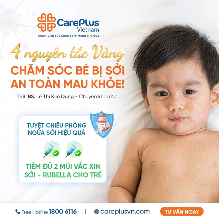 4 NGUYÊN TẮC VÀNG - CHĂM SÓC TRẺ BỊ SỞI AN TOÀN, MAU KHỎE 