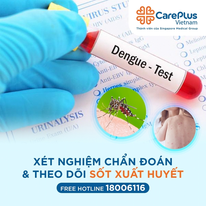 Xét nghiệm chẩn đoán và theo dõi sốt xuất huyết 