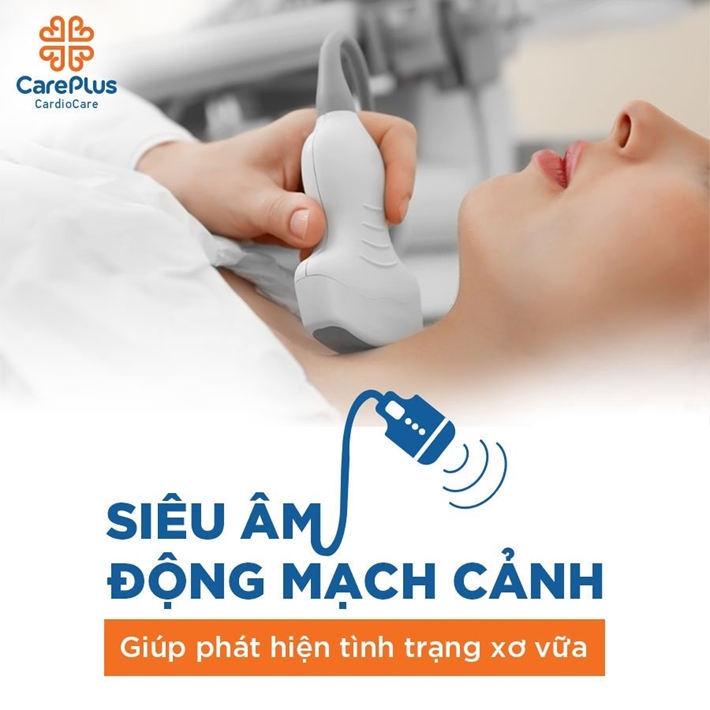 Tầm soát xơ vữa mạch máu đề phòng nguy cơ đột quỵ - đột tử