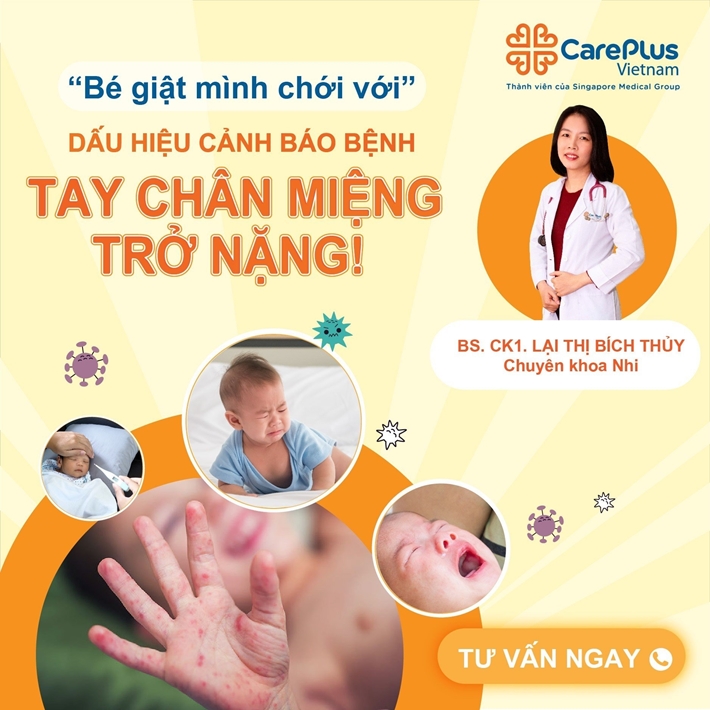 “Trẻ giật mình chới với”: Dấu hiệu cảnh báo bệnh tay chân miệng trở nặng